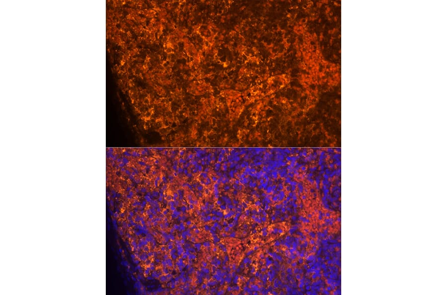 Immunofluorescence - Anti-RANTES Antibody (A92294) - Antibodies.com