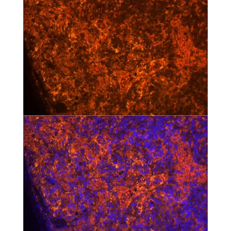 Immunofluorescence - Anti-RANTES Antibody (A92294) - Antibodies.com