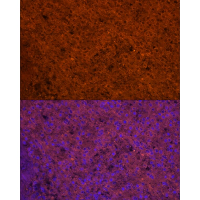 Immunofluorescence - Anti-RANTES Antibody (A92294) - Antibodies.com