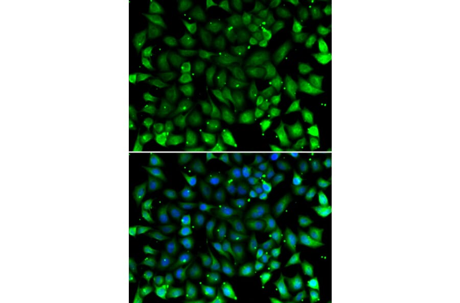 Immunofluorescence - Anti-CCL26 Antibody (A11980) - Antibodies.com