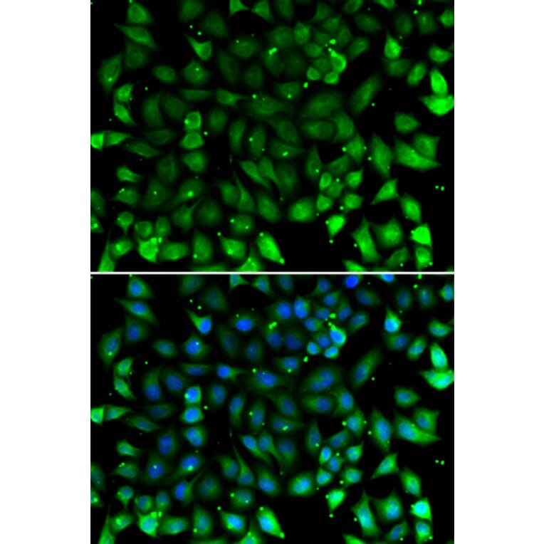Immunofluorescence - Anti-CCL26 Antibody (A11980) - Antibodies.com
