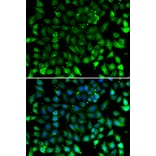 Immunofluorescence - Anti-CCL26 Antibody (A11980) - Antibodies.com