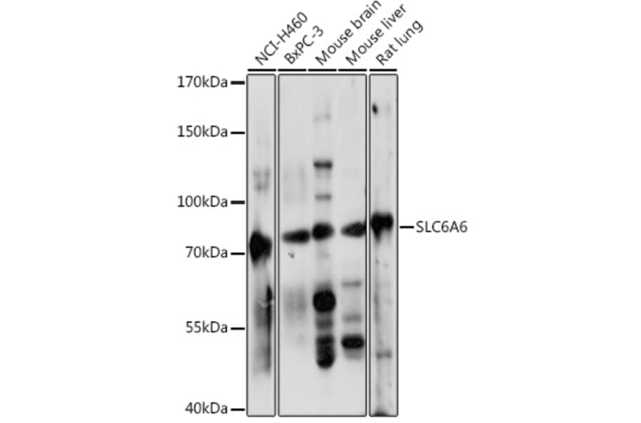 Western Blot - Anti-Slc6a6/Taut Antibody (A92297) - Antibodies.com