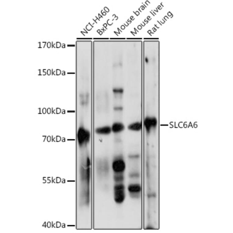 Western Blot - Anti-Slc6a6/Taut Antibody (A92297) - Antibodies.com
