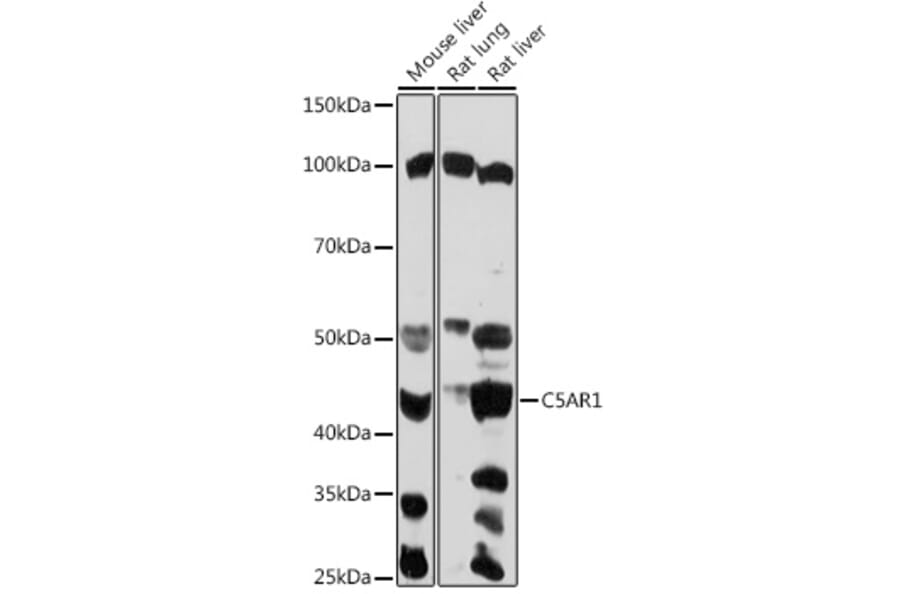 Western Blot - Anti-C5a-R Antibody (A92299) - Antibodies.com