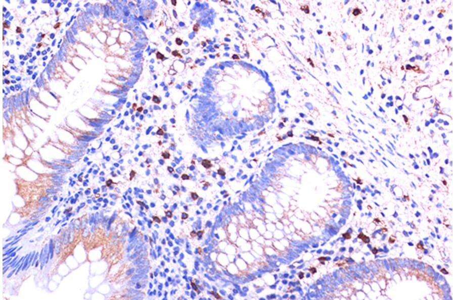 Immunohistochemistry - Anti-C5a-R Antibody (A92299) - Antibodies.com