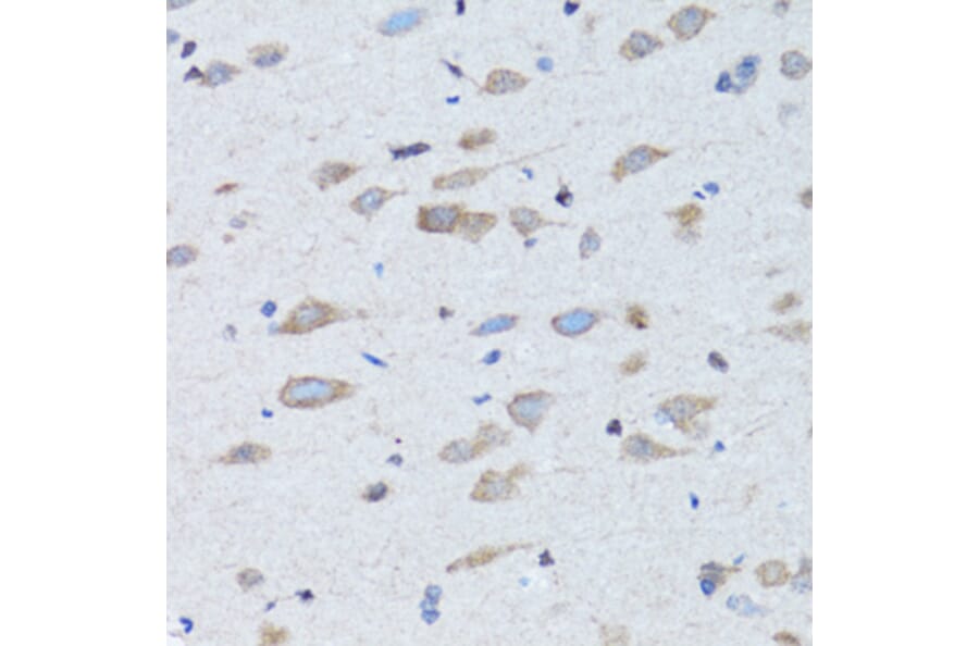 Immunohistochemistry - Anti-NDP Antibody (A12470) - Antibodies.com