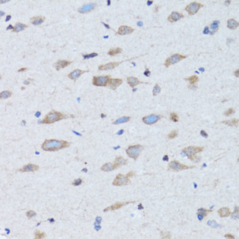 Immunohistochemistry - Anti-NDP Antibody (A12470) - Antibodies.com