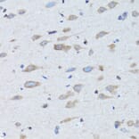 Immunohistochemistry - Anti-NDP Antibody (A12470) - Antibodies.com