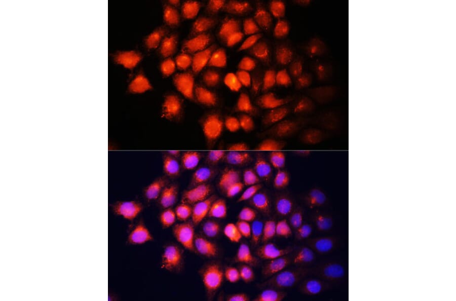 Immunofluorescence - Anti-IGF2 Antibody (A92304) - Antibodies.com