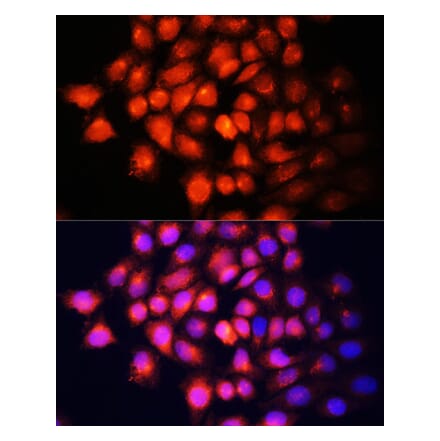 Immunofluorescence - Anti-IGF2 Antibody (A92304) - Antibodies.com