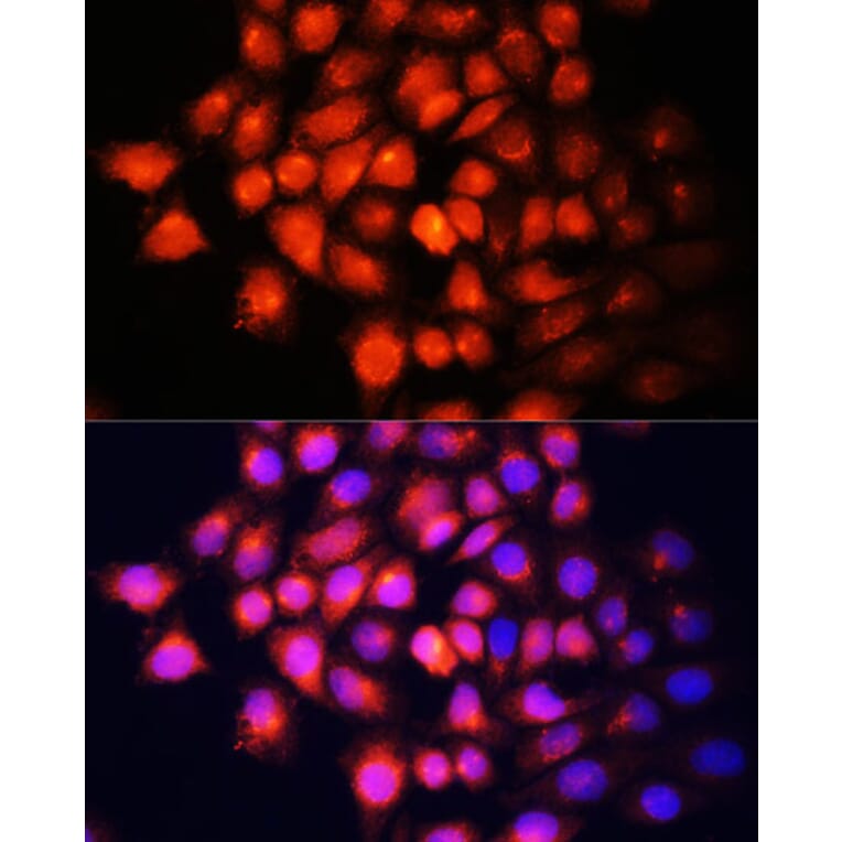 Immunofluorescence - Anti-IGF2 Antibody (A92304) - Antibodies.com