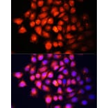 Immunofluorescence - Anti-IGF2 Antibody (A92304) - Antibodies.com