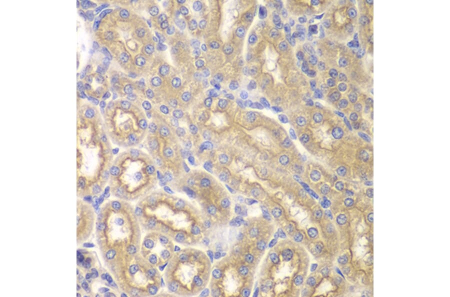 Immunohistochemistry - Anti-IL12RB1 Antibody (A13319) - Antibodies.com