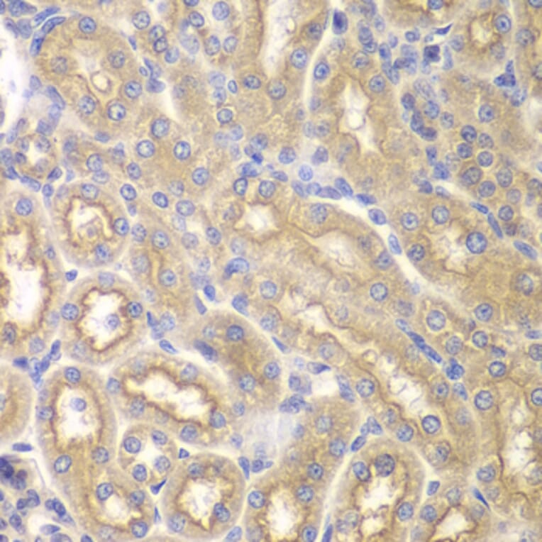 Immunohistochemistry - Anti-IL12RB1 Antibody (A13319) - Antibodies.com