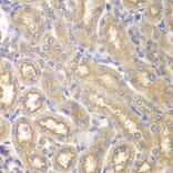 Immunohistochemistry - Anti-IL12RB1 Antibody (A13319) - Antibodies.com