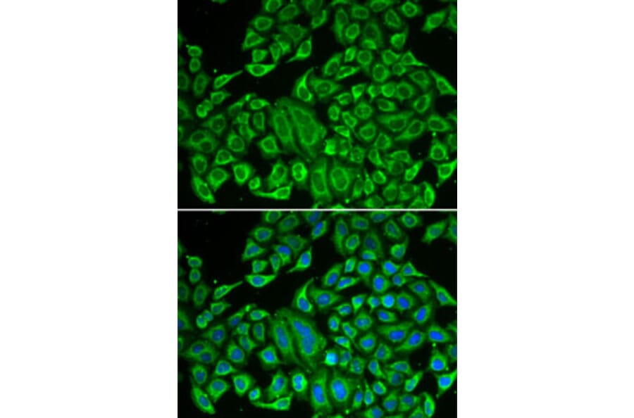 Immunofluorescence - Anti-IL12RB1 Antibody (A13319) - Antibodies.com