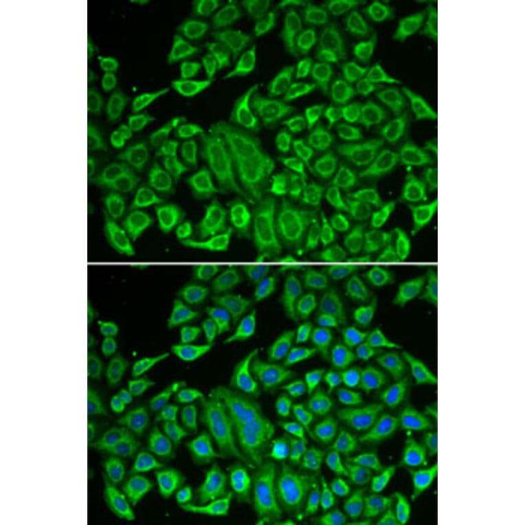 Immunofluorescence - Anti-IL12RB1 Antibody (A13319) - Antibodies.com