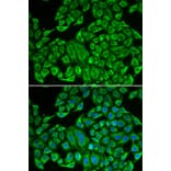 Immunofluorescence - Anti-IL12RB1 Antibody (A13319) - Antibodies.com