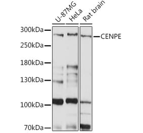 Western Blot - Anti-CENPE Antibody (A92309) - Antibodies.com