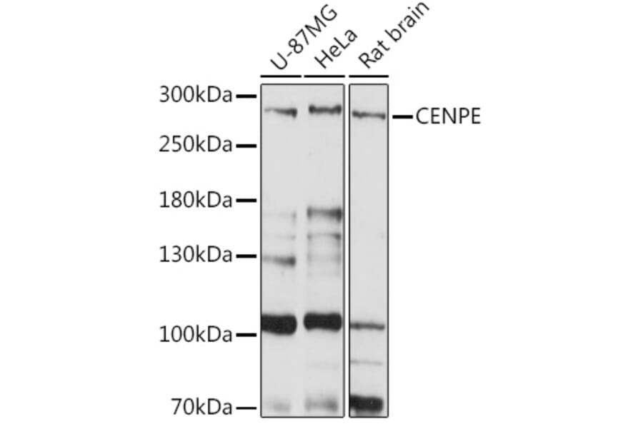 Western Blot - Anti-CENPE Antibody (A92309) - Antibodies.com