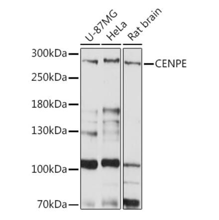 Western Blot - Anti-CENPE Antibody (A92309) - Antibodies.com