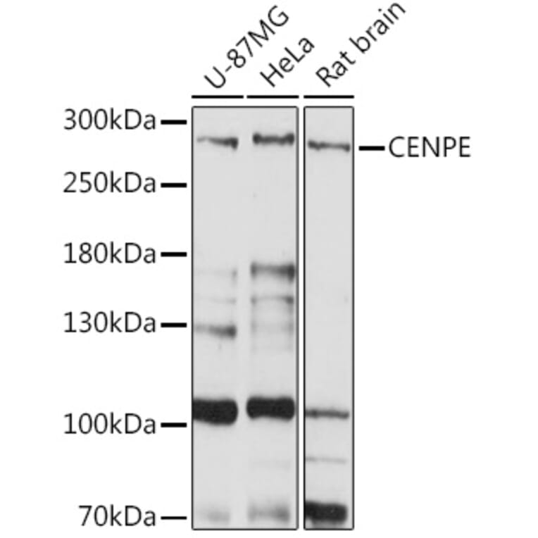 Western Blot - Anti-CENPE Antibody (A92309) - Antibodies.com