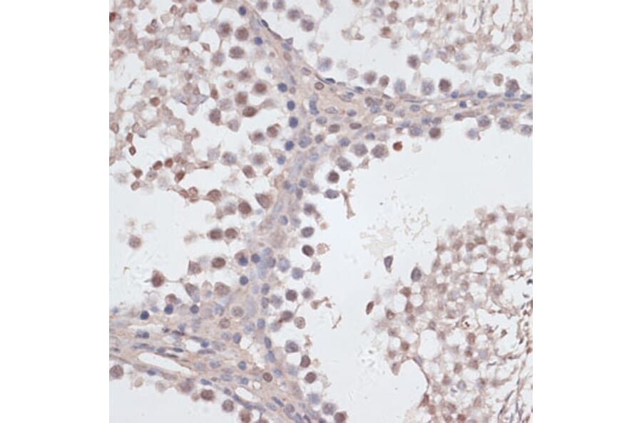Immunohistochemistry - Anti-CCNE2 Antibody (A14086) - Antibodies.com