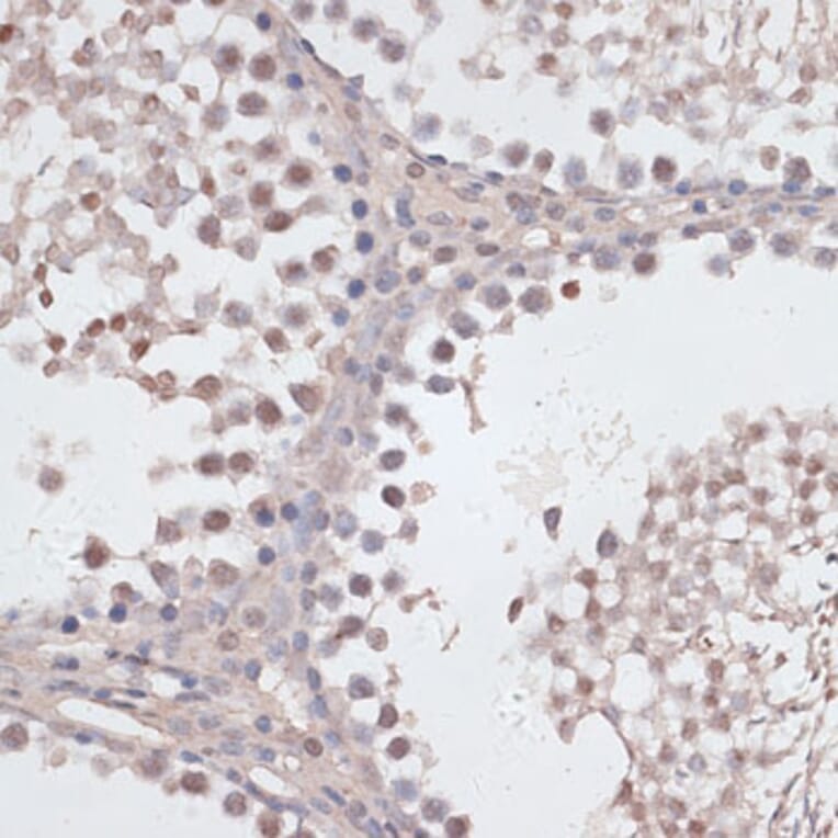 Immunohistochemistry - Anti-CCNE2 Antibody (A14086) - Antibodies.com