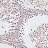 Immunohistochemistry - Anti-CCNE2 Antibody (A14086) - Antibodies.com
