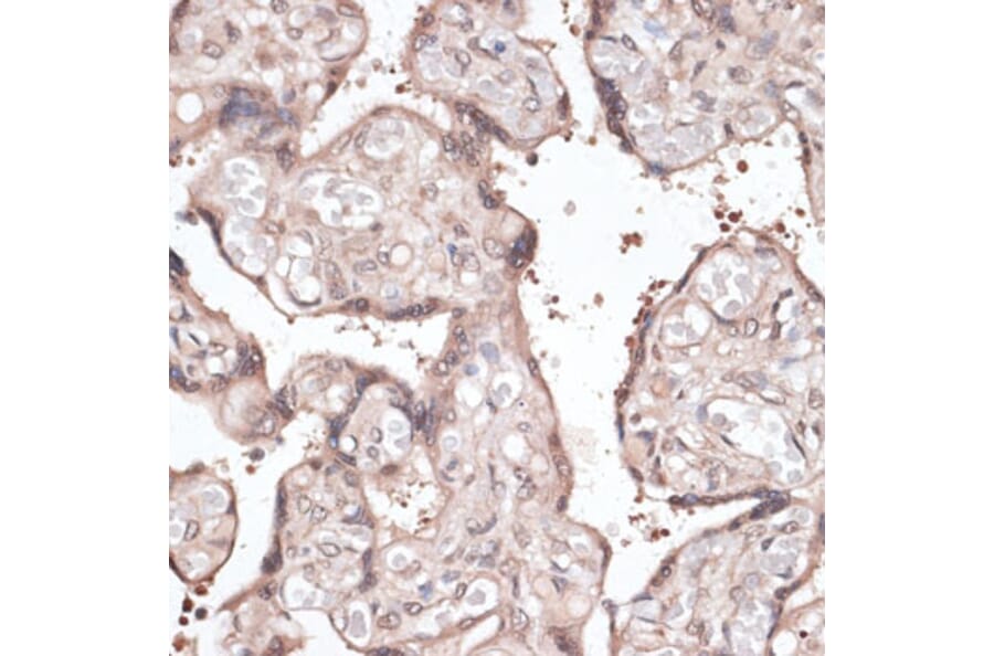 Immunohistochemistry - Anti-CCNE2 Antibody (A14086) - Antibodies.com