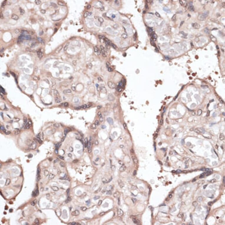 Immunohistochemistry - Anti-CCNE2 Antibody (A14086) - Antibodies.com