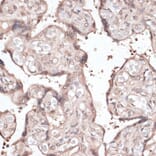 Immunohistochemistry - Anti-CCNE2 Antibody (A14086) - Antibodies.com