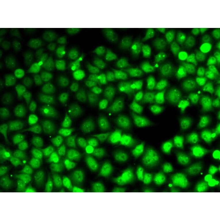 Immunofluorescence - Anti-CCNE2 Antibody (A14086) - Antibodies.com