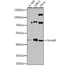 Western Blot - Anti-SMAD6 Antibody (A92311) - Antibodies.com