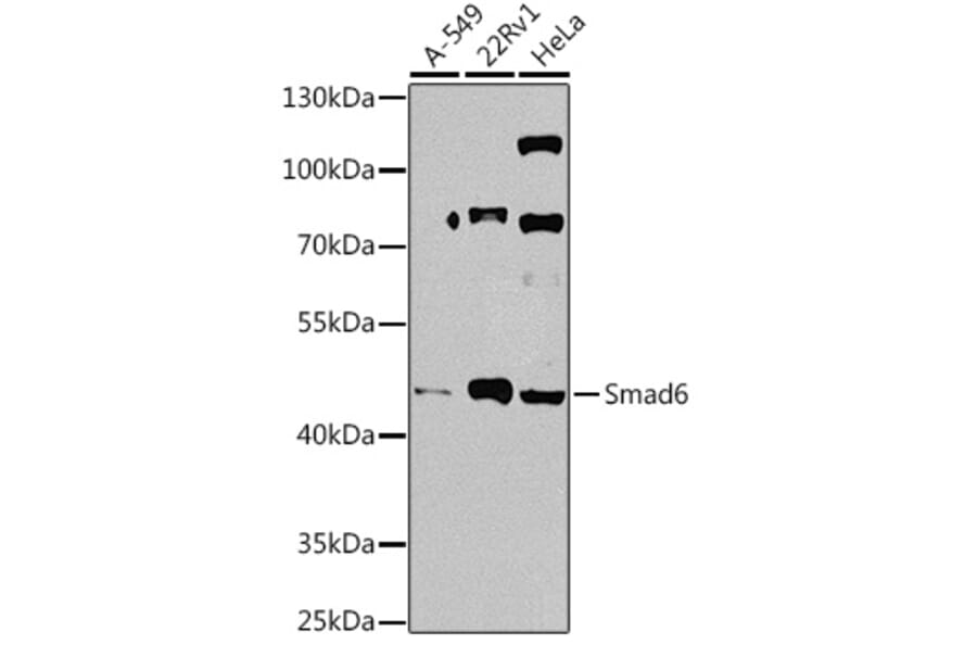 Western Blot - Anti-SMAD6 Antibody (A92311) - Antibodies.com
