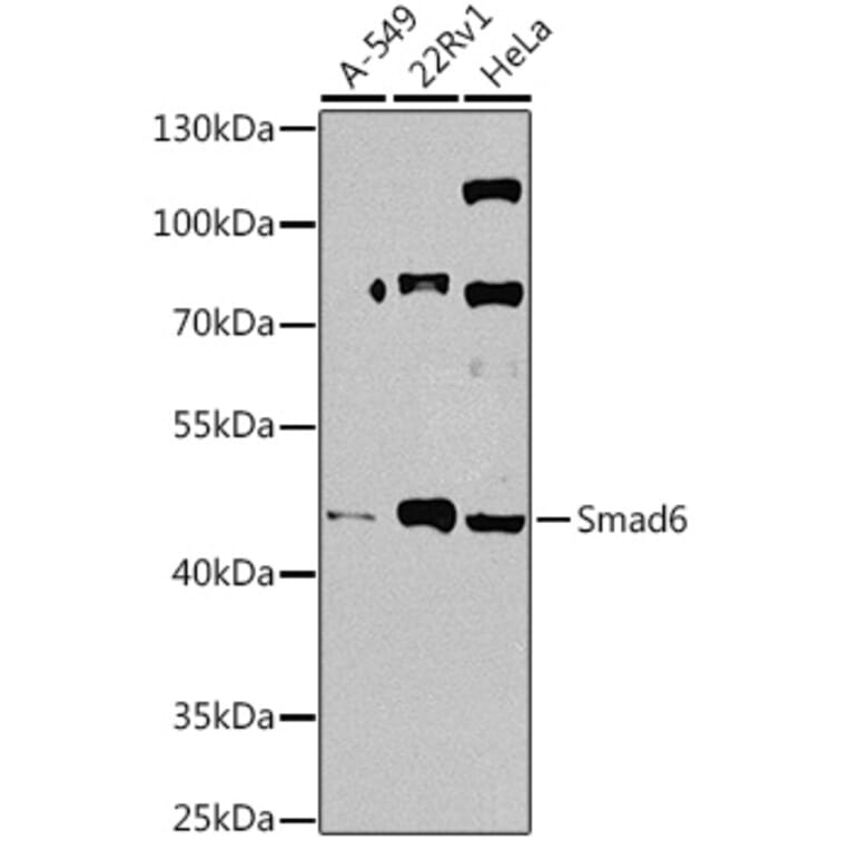 Western Blot - Anti-SMAD6 Antibody (A92311) - Antibodies.com