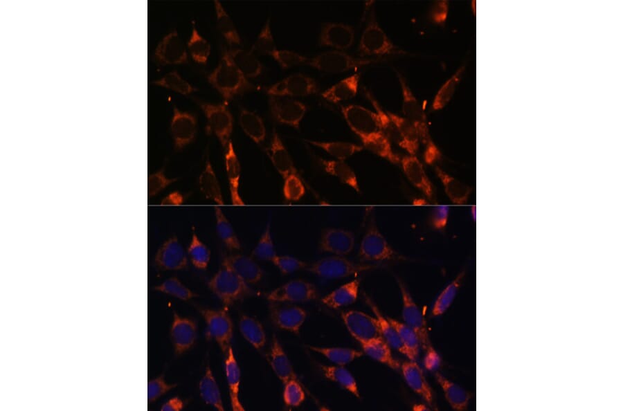 Immunofluorescence - Anti-SMAD6 Antibody (A92311) - Antibodies.com
