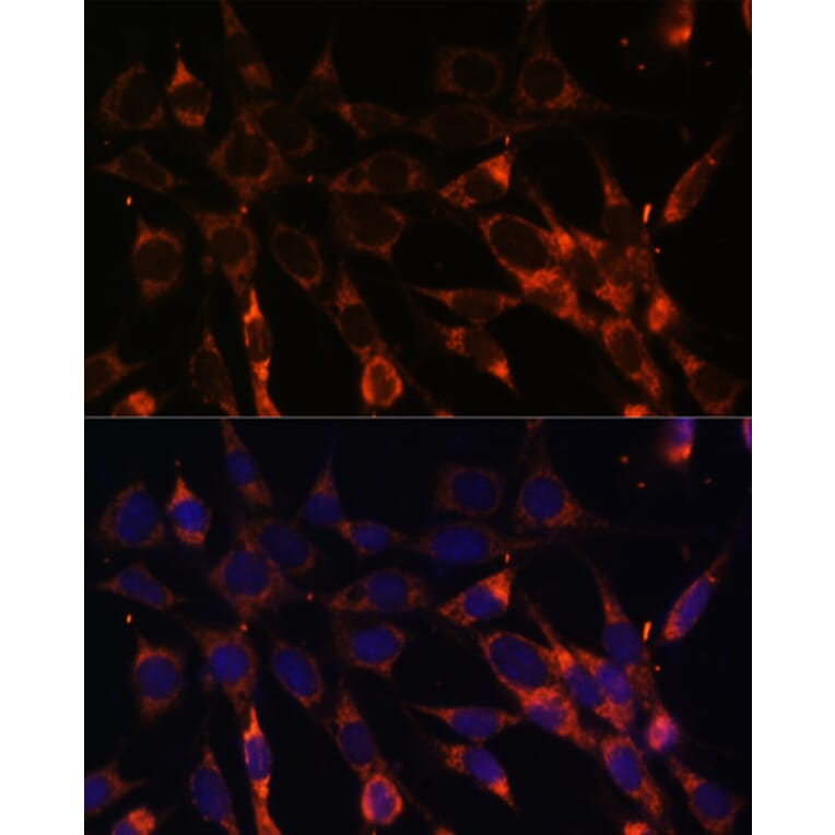 Immunofluorescence - Anti-SMAD6 Antibody (A92311) - Antibodies.com