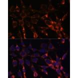 Immunofluorescence - Anti-SMAD6 Antibody (A92311) - Antibodies.com