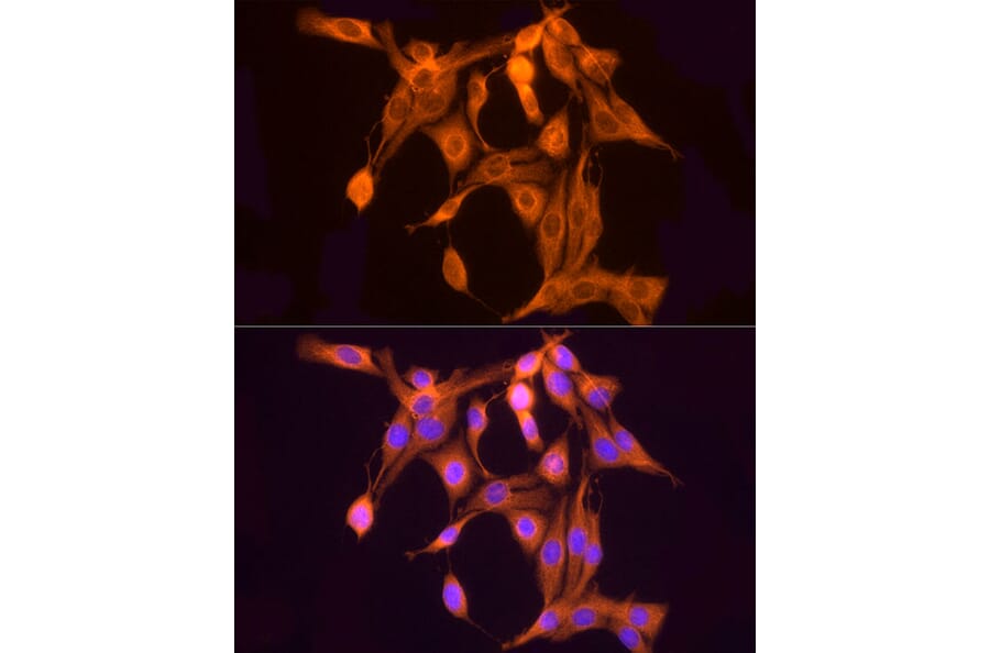 Immunofluorescence - Anti-ULBP2 Antibody (A92312) - Antibodies.com