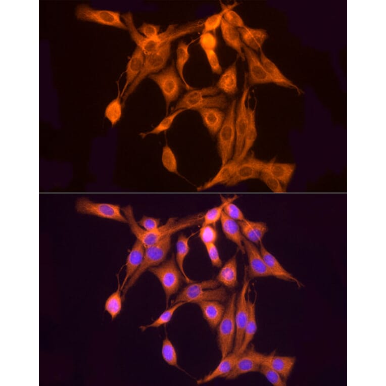 Immunofluorescence - Anti-ULBP2 Antibody (A92312) - Antibodies.com