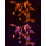 Immunofluorescence - Anti-ULBP2 Antibody (A92312) - Antibodies.com