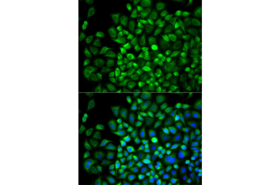 Immunofluorescence - Anti-ANGPTL4 Antibody (A13425) - Antibodies.com