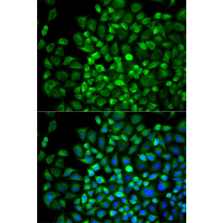 Immunofluorescence - Anti-ANGPTL4 Antibody (A13425) - Antibodies.com