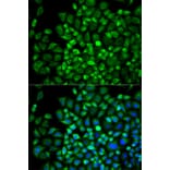 Immunofluorescence - Anti-ANGPTL4 Antibody (A13425) - Antibodies.com