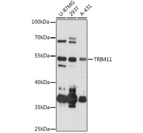 Western Blot - Anti-TRIM11 Antibody (A92316) - Antibodies.com