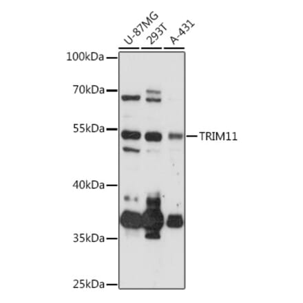 Western Blot - Anti-TRIM11 Antibody (A92316) - Antibodies.com