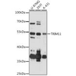 Western Blot - Anti-TRIM11 Antibody (A92316) - Antibodies.com