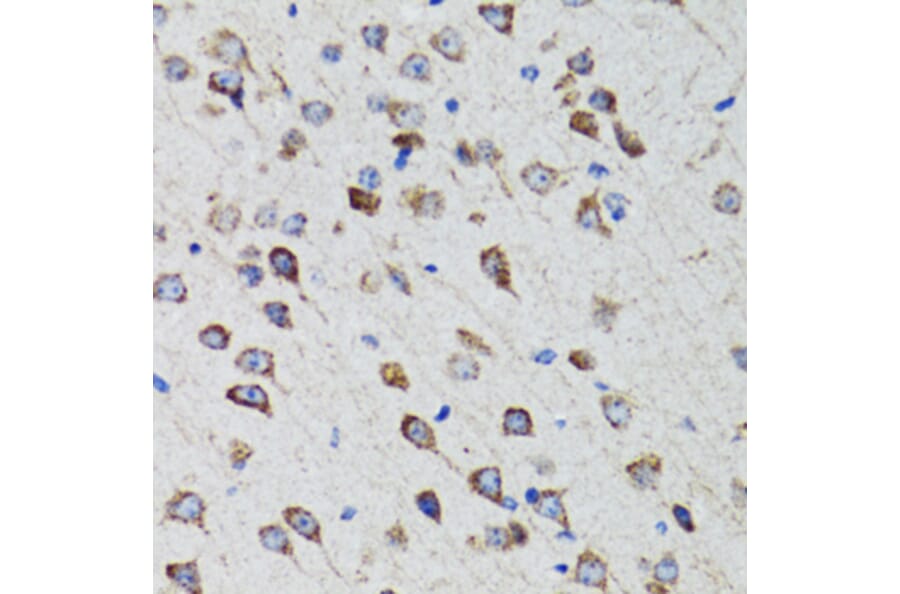 Immunohistochemistry - Anti-HEXA Antibody (A92320) - Antibodies.com